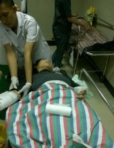 Diduga Cemburu, Suami Bacok Kedua Lengan Istri Hingga Nyaris Putus