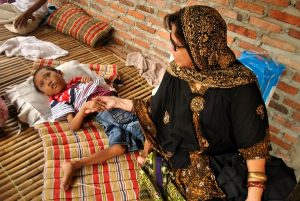 Bocah 10 Tahun Menderita Gizi Buruk, Komisi Nasional Perlindungan Anak Kritik Kinerja Bupati Bekasi