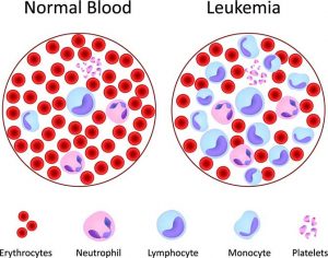 Pertama Kali, Dua Bayi Ini Berhasil Sembuh dari Leukemia