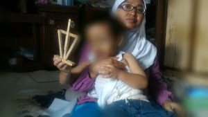 Balita di Margahayu 4 Tahun Bertahan Hidup Tanpa Anus