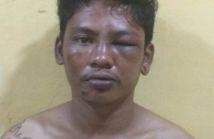 Pencuri HP Pukuli Korban Pakai Tabung Elpiji 3 Kg di Setu