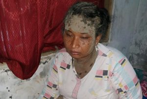 Sedang Asyik Ngobrol, Ibu-ibu Diserang Tawon Ndas