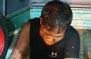 Melukai Orang, Jambret di Margahayu depan Unisma Dihajar Massa