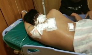 Pemuda Diserang di Medansatria, Alami Luka Bacok di Punggung