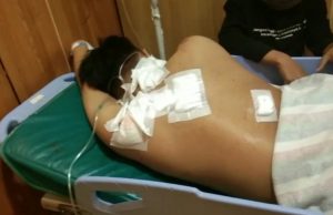 Pemuda Diserang di Medansatria, Alami Luka Bacok di Punggung