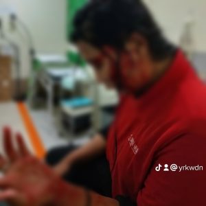 Tak Terima Nomor Hp Diblokir, Karyawati di Pondok Gede Dianiaya Mantan