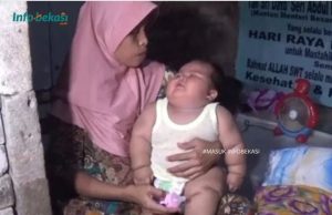 Hasil Pemeriksaan Dokter, Raisya Mengalami Gangguan Saraf