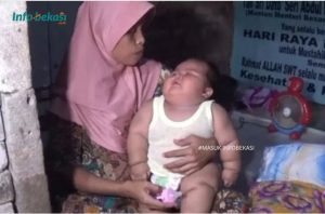 Hasil Pemeriksaan Dokter, Raisya Mengalami Gangguan Saraf