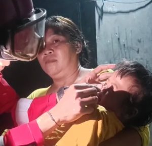 Evakuasi Dramatis, Petugas Damkar Keluarkan Tutup Pulpen dari Dalam Hidung Balita