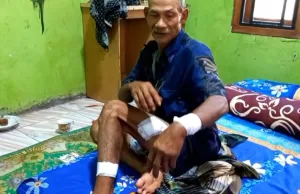 Ini Koronologi Lansia Dicegat Begal di Setu, Motor Raib dan Kena Bacok